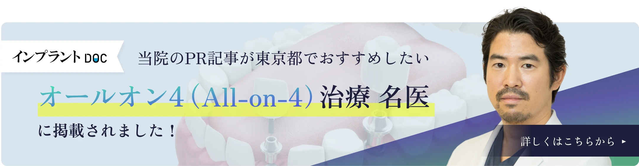 【PR】当院のPR記事が「東京都でおすすめしたいオールオン4治療 名医」に掲載されました 詳しくはこちらから