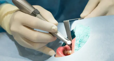 歯の治療をしている様子